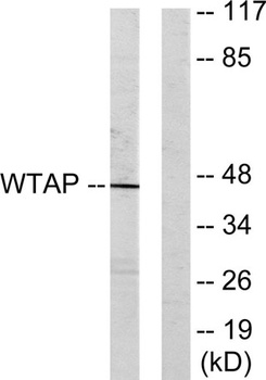 WTAP rabbit pAb Antibody
