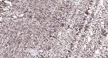 WTAP rabbit pAb Antibody