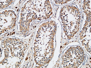 XIAP rabbit pAb Antibody