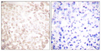 XRCC1 rabbit pAb Antibody