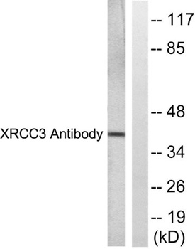 XRCC3 rabbit pAb Antibody