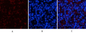 YAP rabbit pAb Antibody