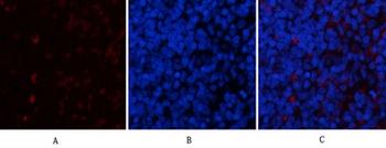 YAP rabbit pAb Antibody