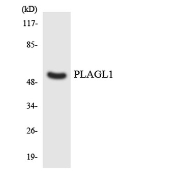 ZAC1 rabbit pAb Antibody