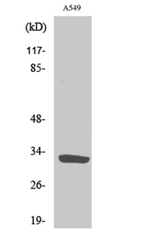 ZIP9 rabbit pAb Antibody