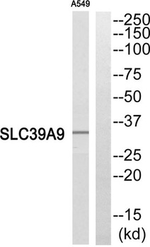 ZIP9 rabbit pAb Antibody
