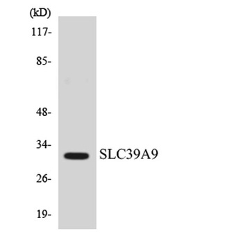 ZIP9 rabbit pAb Antibody