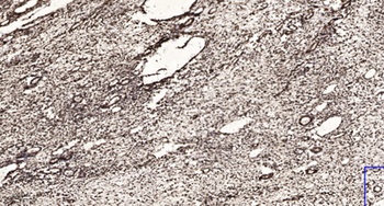 ZIS rabbit pAb Antibody