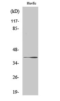 β-1,3-Gal-T1 rabbit pAb Antibody
