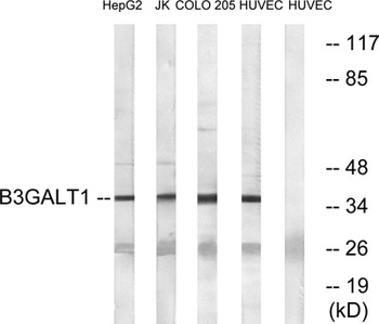 β-1,3-Gal-T1 rabbit pAb Antibody