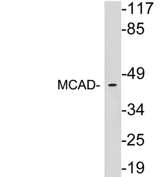 MCAD rabbit pAb Antibody