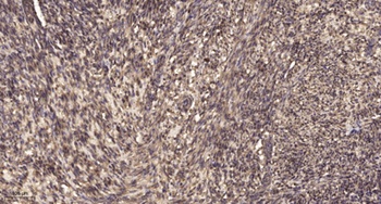 MCAD rabbit pAb Antibody