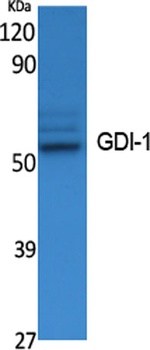 GDI-1 rabbit pAb Antibody