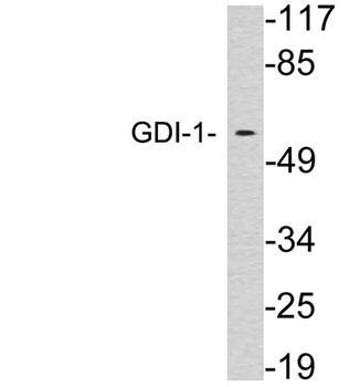 GDI-1 rabbit pAb Antibody