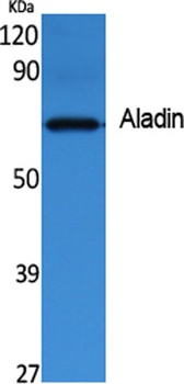 Aladin rabbit pAb Antibody