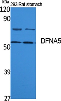 DFNA5 rabbit pAb Antibody