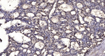 Sox-17 rabbit pAb Antibody