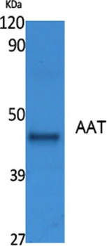 AAT rabbit pAb Antibody