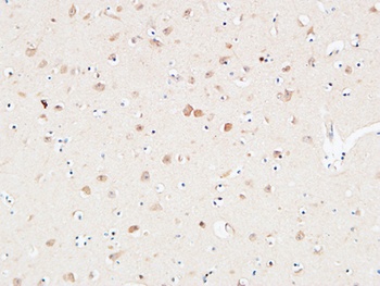 AAT rabbit pAb Antibody