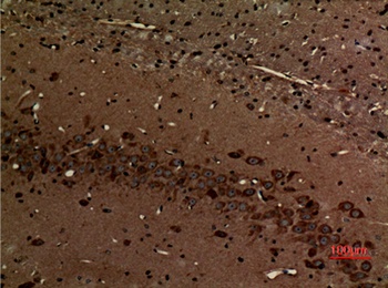 Myosin VI rabbit pAb Antibody