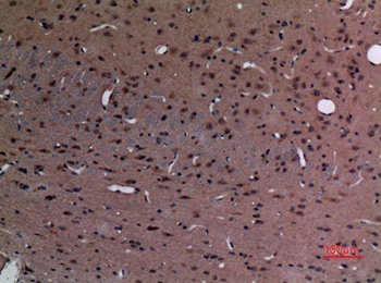 Stathmin-2 rabbit pAb Antibody