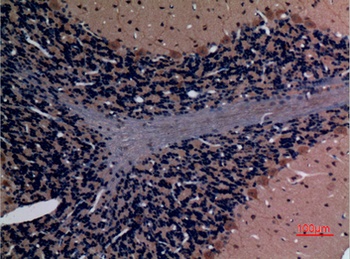 Stathmin-2 rabbit pAb Antibody