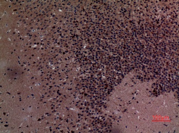 Stathmin-2 rabbit pAb Antibody