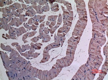 UBE4A rabbit pAb Antibody