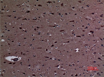 SS-56 rabbit pAb Antibody