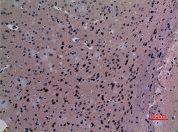 TudorSN rabbit pAb Antibody