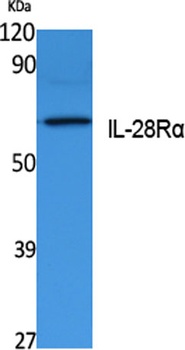 IL-28Rα rabbit pAb Antibody