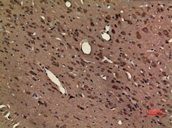 Fractalkine Receptor rabbit pAb