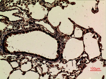 JAM-B rabbit pAb Antibody