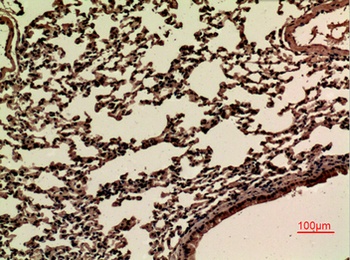 JAM-B rabbit pAb Antibody