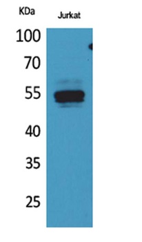 DPP7 rabbit pAb Antibody