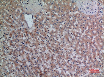 DPP7 rabbit pAb Antibody