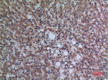 DPP7 rabbit pAb Antibody