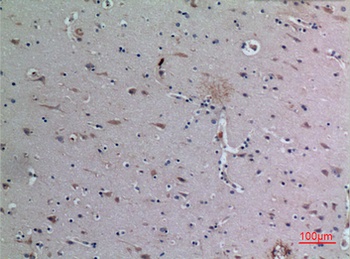 DPP7 rabbit pAb Antibody