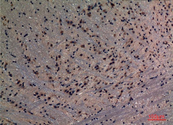 PREP rabbit pAb Antibody