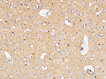 IL-10 rabbit pAb Antibody