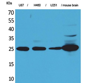 UCH-L1 rabbit pAb Antibody