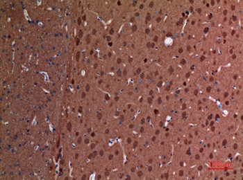 UCH-L1 rabbit pAb Antibody
