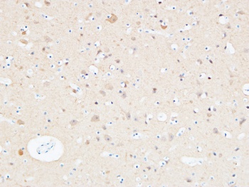UCH-L1 rabbit pAb Antibody