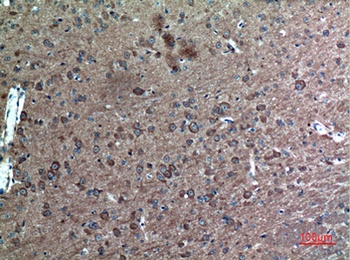 FAF1 rabbit pAb Antibody