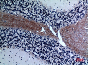 Eotaxin-3 rabbit pAb Antibody