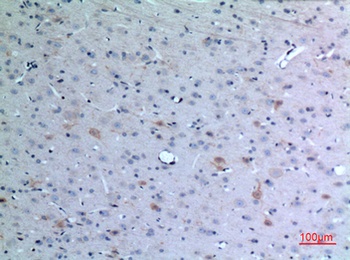 Eotaxin-3 rabbit pAb Antibody
