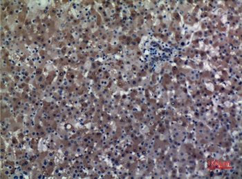 ALDH1A1 rabbit pAb Antibody