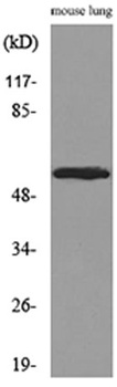 ALDH1A1 rabbit pAb Antibody