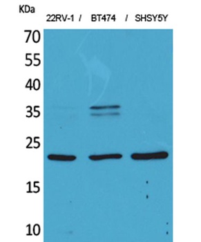 FGF-12 rabbit pAb Antibody