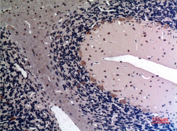 FGF-12 rabbit pAb Antibody